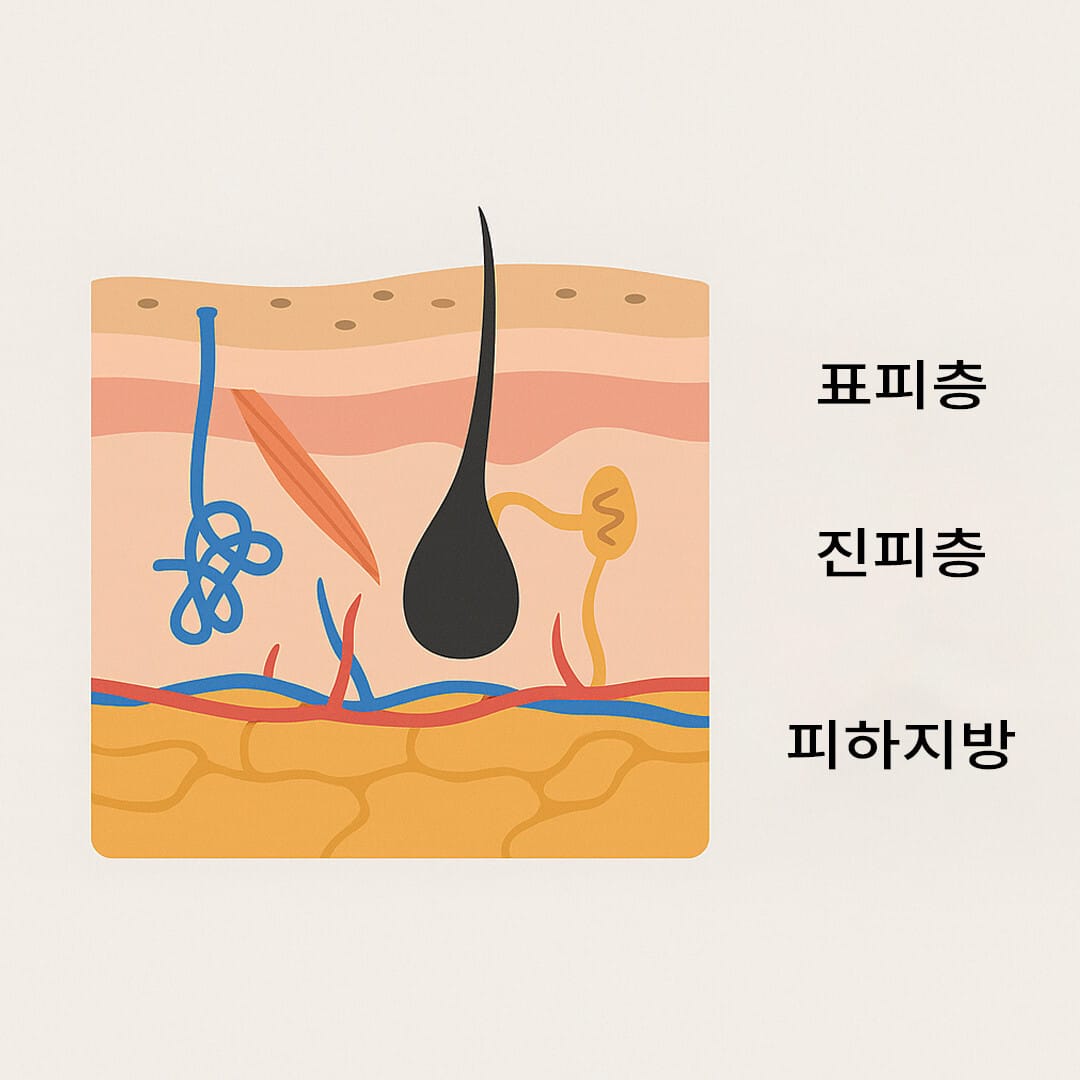 피부 조직의 단면도
